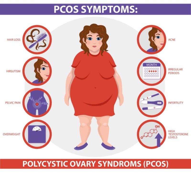 PCOS inozitol menstruacia